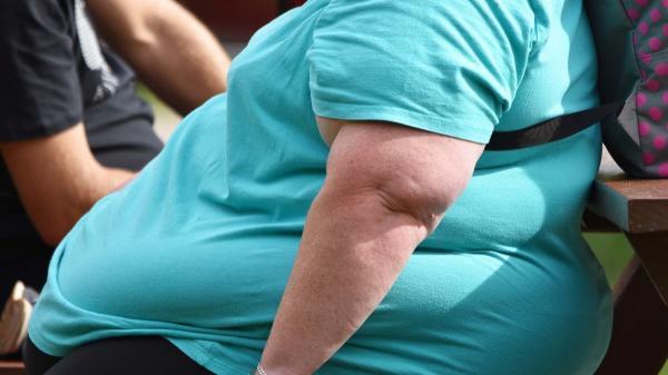 خبرنگاران نیمی از مبتلایان به کرونا در آمریکا افراد چاق هستند